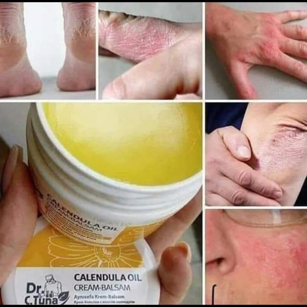COPY - Dr.Tuna Caléndula cream balsam 3.7 fl.oz